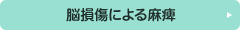 脳損傷による麻痺