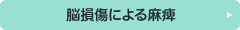 脳損傷による麻痺